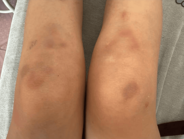 皇冠信用代理_女子自称因工资问题被老板锁办公室里打 警方:双方已到派出所皇冠信用代理,是否打人还在调查