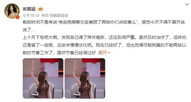 如何代理皇冠信用网_张靓颖发长文谈身体状况如何代理皇冠信用网，自曝得带状疱疹、旧伤复发，取消跨年演唱会加场计划